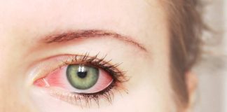 7 Causes of Red Eyes Besides Pink Eye